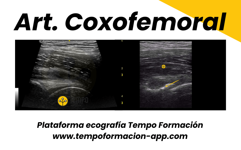 4.  Ecografia Tempo Formacion Articulacion Coxofemoral.png